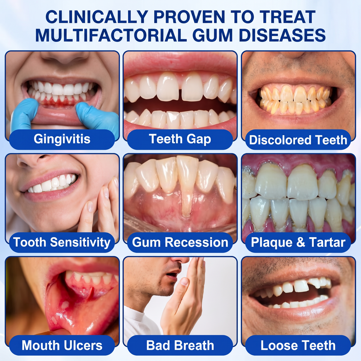 🇪🇸Pureluxo® 🦷Gel de reparación periodontal GumRevive🌿