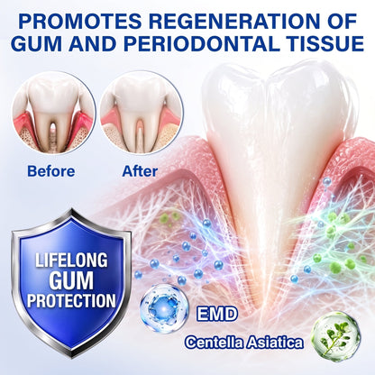 🇪🇸Pureluxo® 🦷Gel de reparación periodontal GumRevive🌿