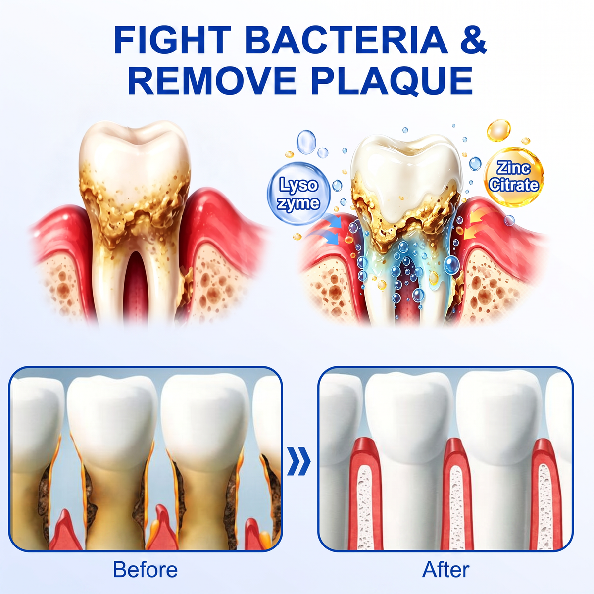 🇪🇸Pureluxo® 🦷Gel de reparación periodontal GumRevive🌿