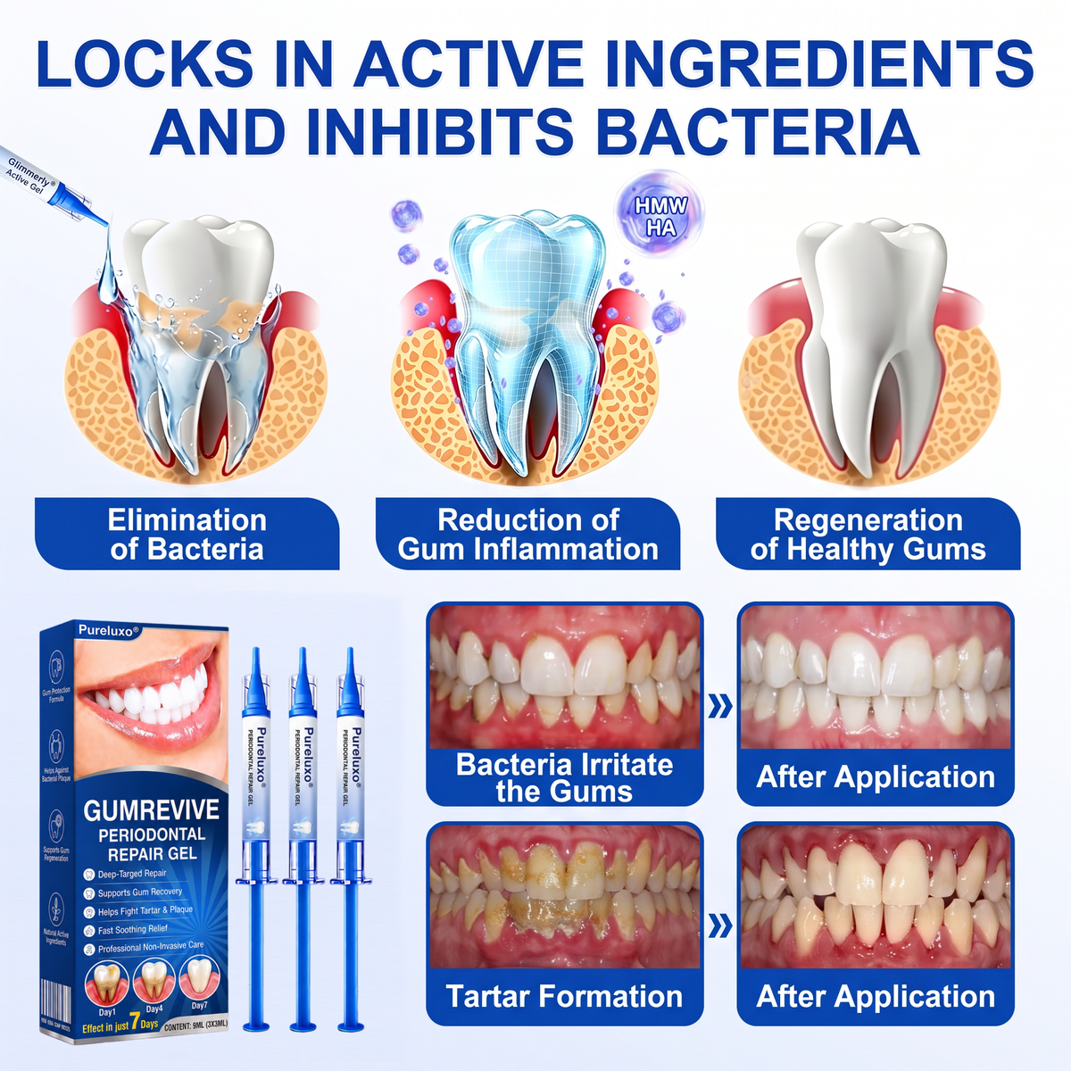 🇪🇸Pureluxo® 🦷Gel de reparación periodontal GumRevive🌿