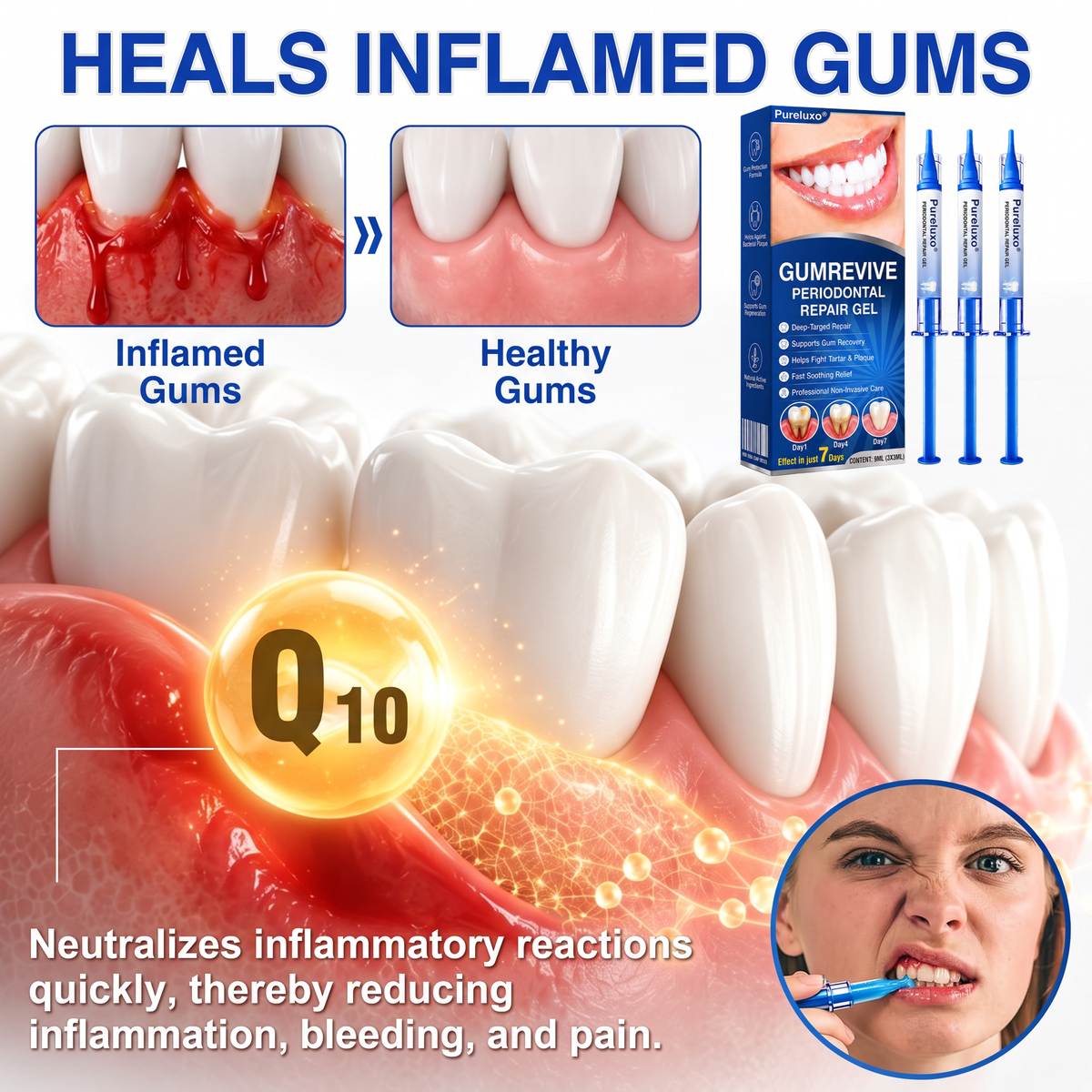 🇪🇸Pureluxo® 🦷Gel de reparación periodontal GumRevive🌿